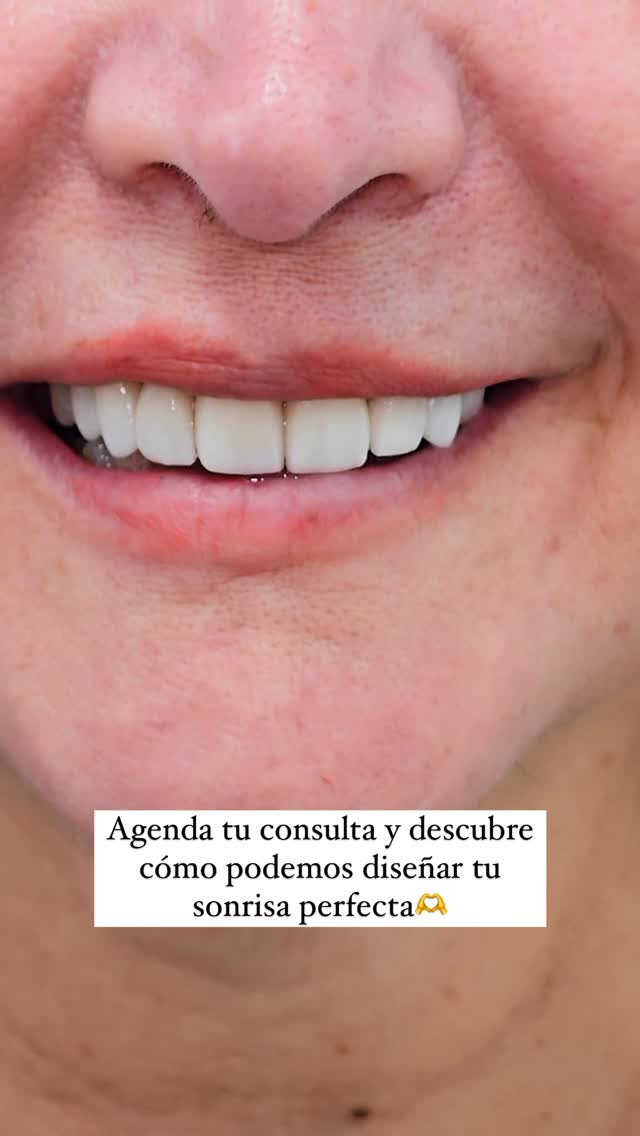 IDent Ortodoncia Invisible & Láser Odontología Digital Facebook ad: 𝐔𝐧𝐚 𝐬𝐨𝐧𝐫𝐢𝐬𝐚 𝐪𝐮𝐞 𝐥𝐨 𝐝𝐢𝐜𝐞 𝐭𝐨𝐝𝐨