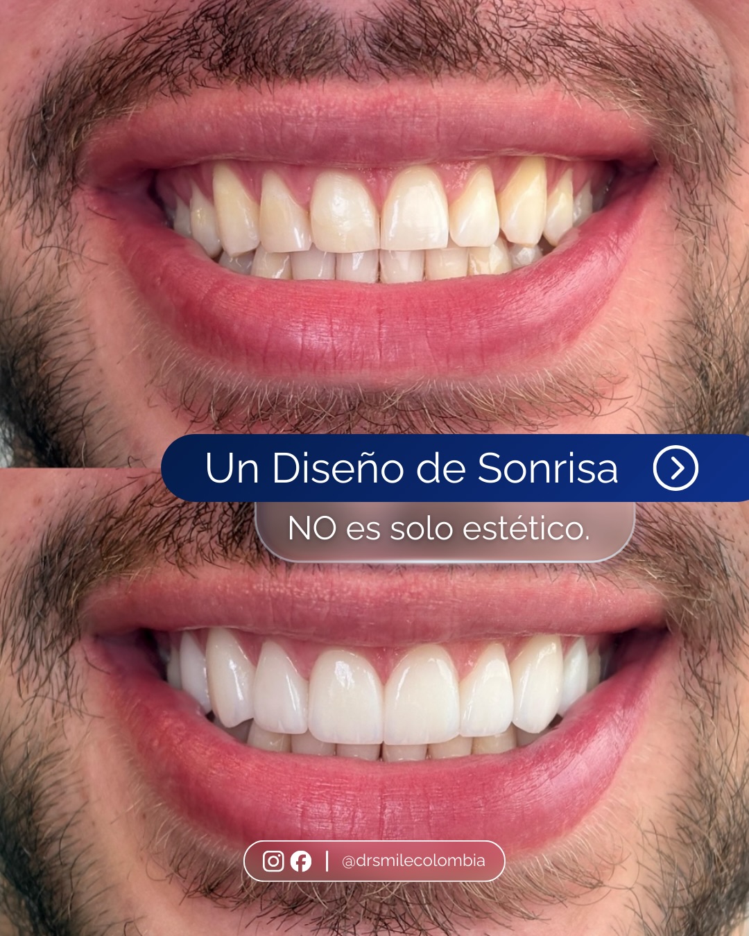Dr. Smile Colombia Facebook ad