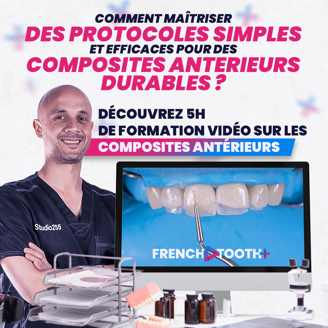 French Tooth Facebook ad