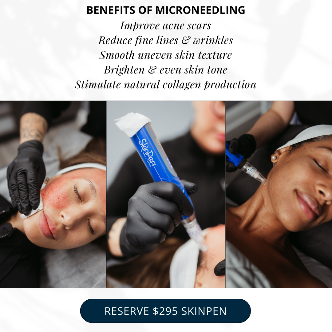 VIO Med Spa - Delray Beach Facebook ad: Reserve $100 OFF SkinPen