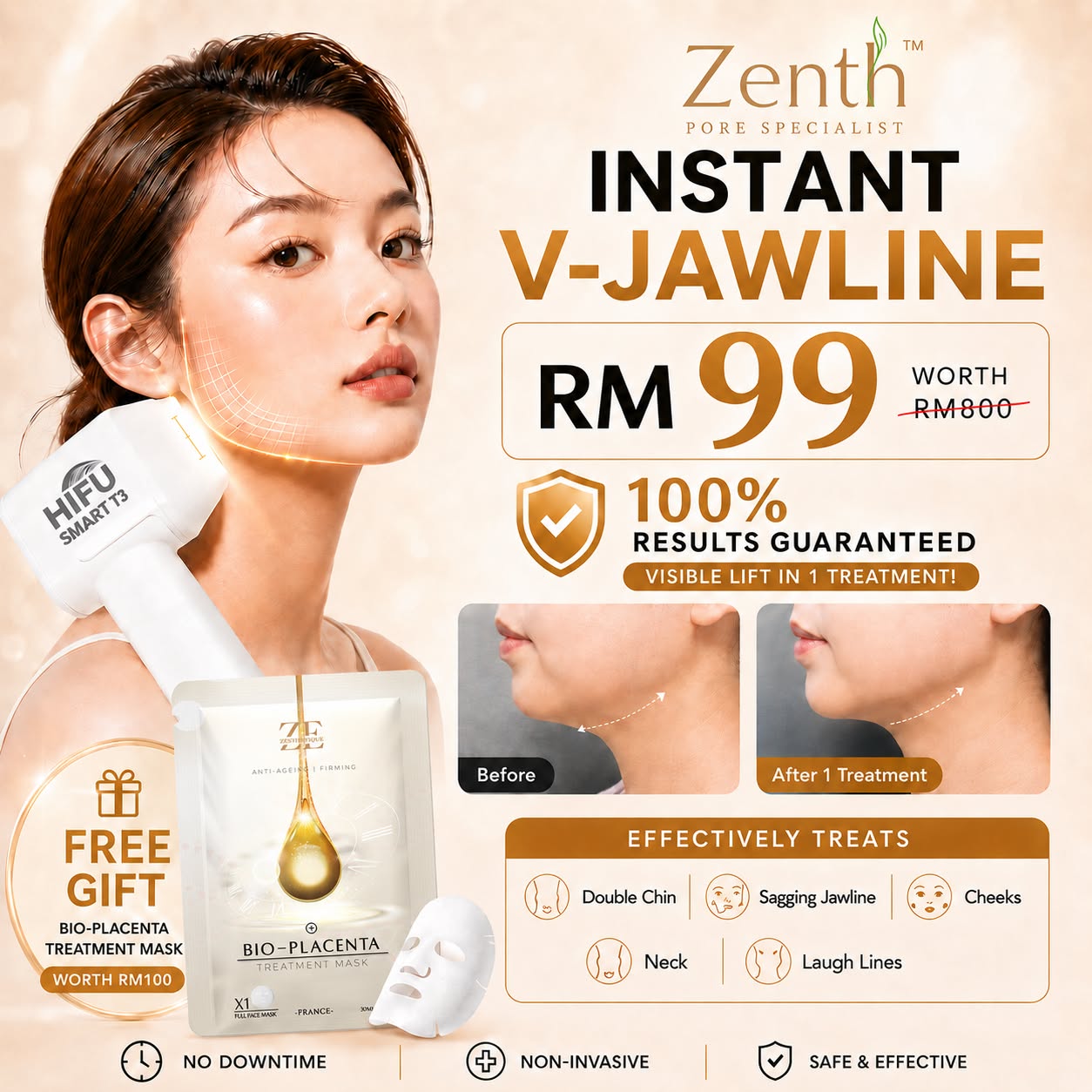 Zenth Pore Specialist Facebook ad: γ ππππ πππ
π π
πππ ππ’ππ γ