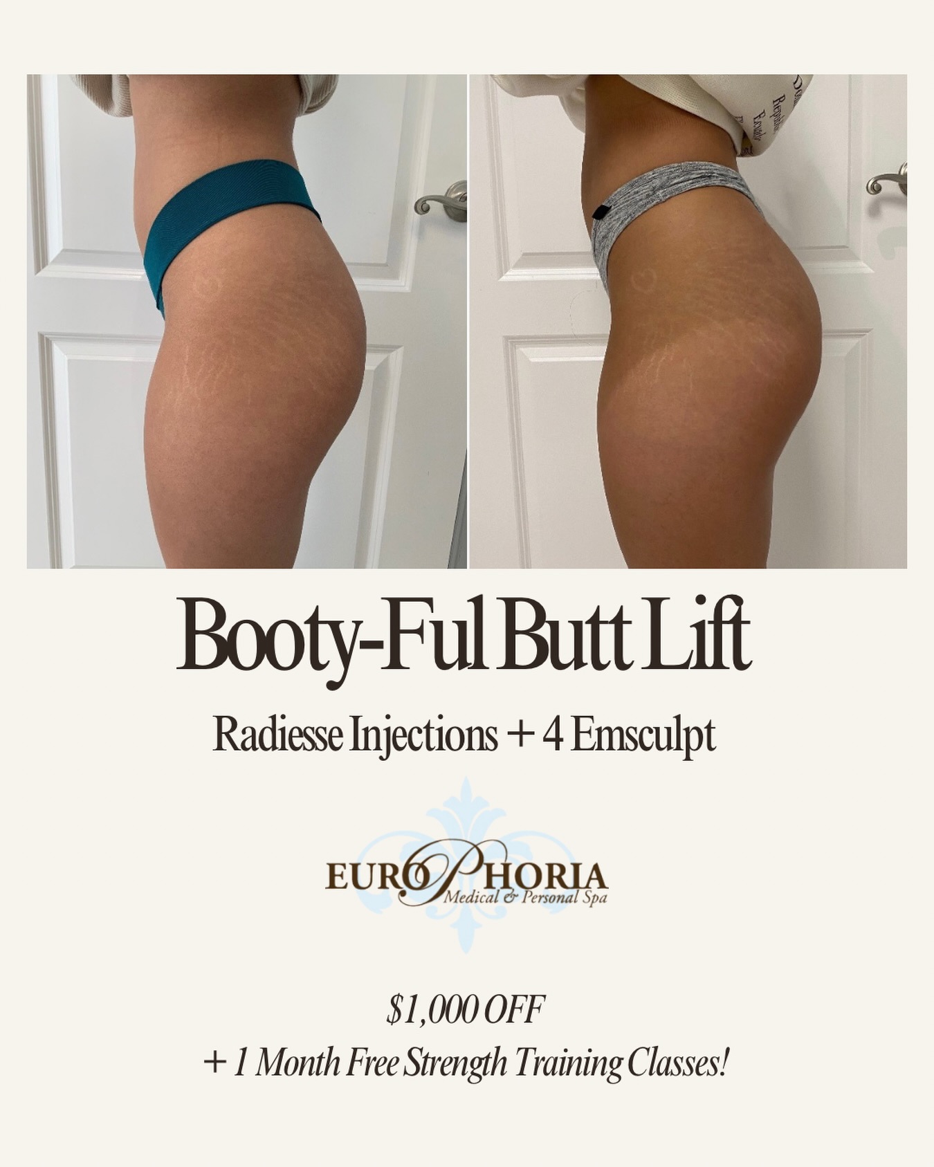 EuroPhoria Medical & Personal Spa Facebook ad: Your summer starts NOW!