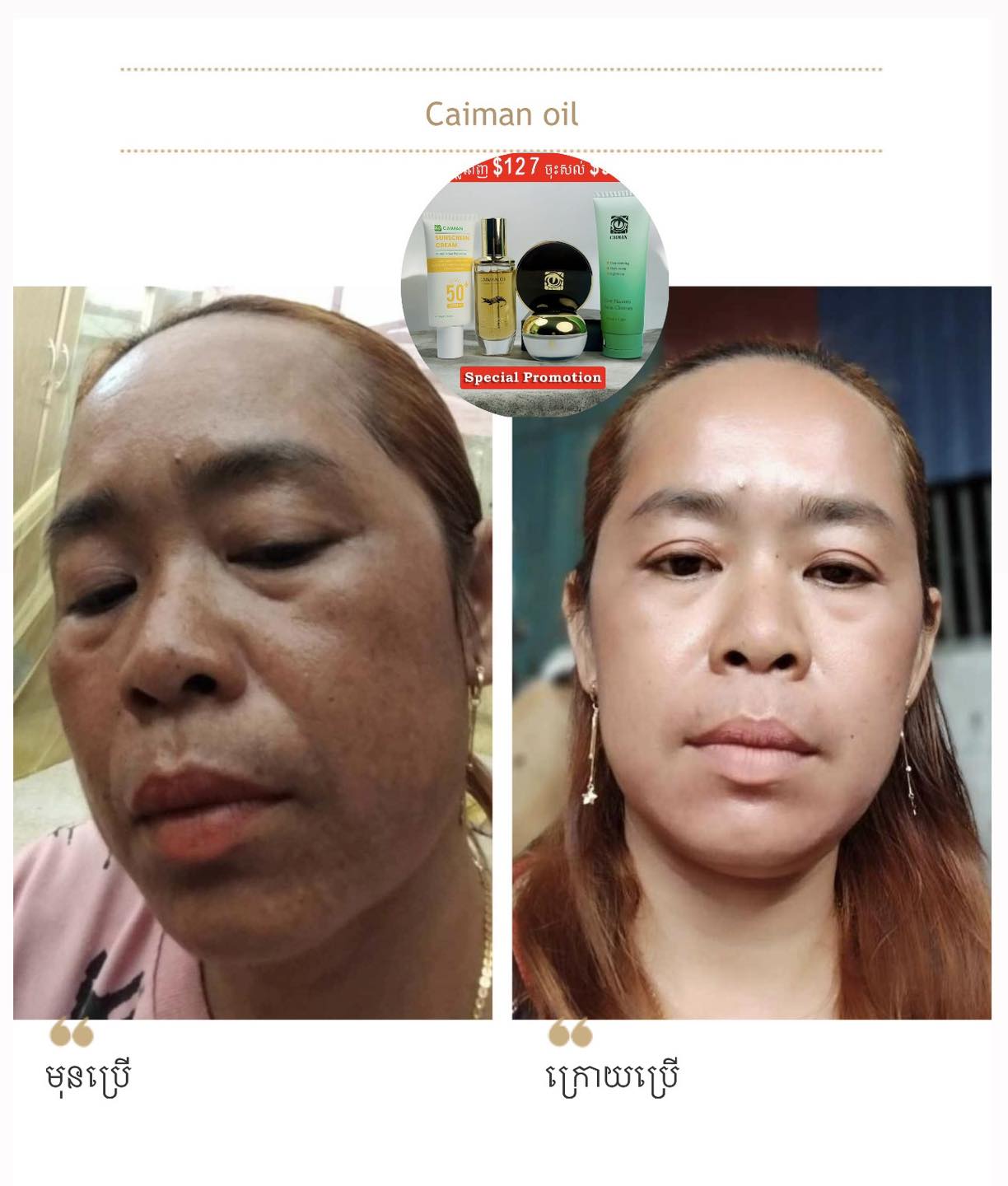Caiman Oil - ប្រេងក្រពើបំបាត់ស្លាកស្នាម Facebook ad