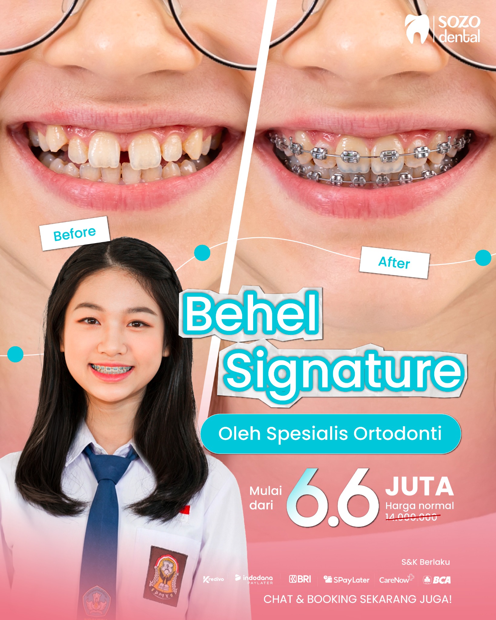 Sozo Dental Clinic Facebook ad: Mau gigi rapi tapi takut mahal?