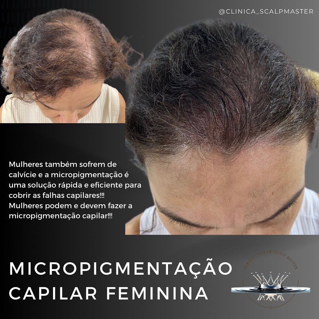Clinica Capilar Scalp Master Facebook ad