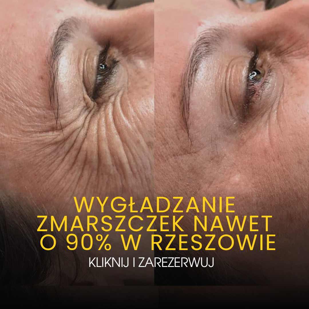 Brzozowska Beauty Clinic - Medycyna Estetyczna Facebook ad: Sprawdź, czy się kwalifikujesz