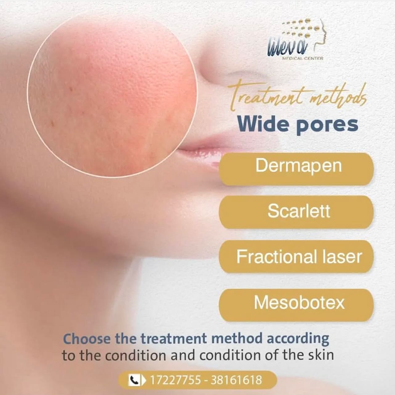 Lileva Beauty Clinic  Facebook ad