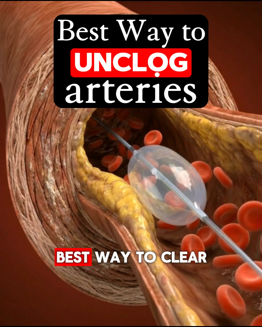 The Health Community Facebook ad: Got Artery Plaque? What Are You Waiting For?