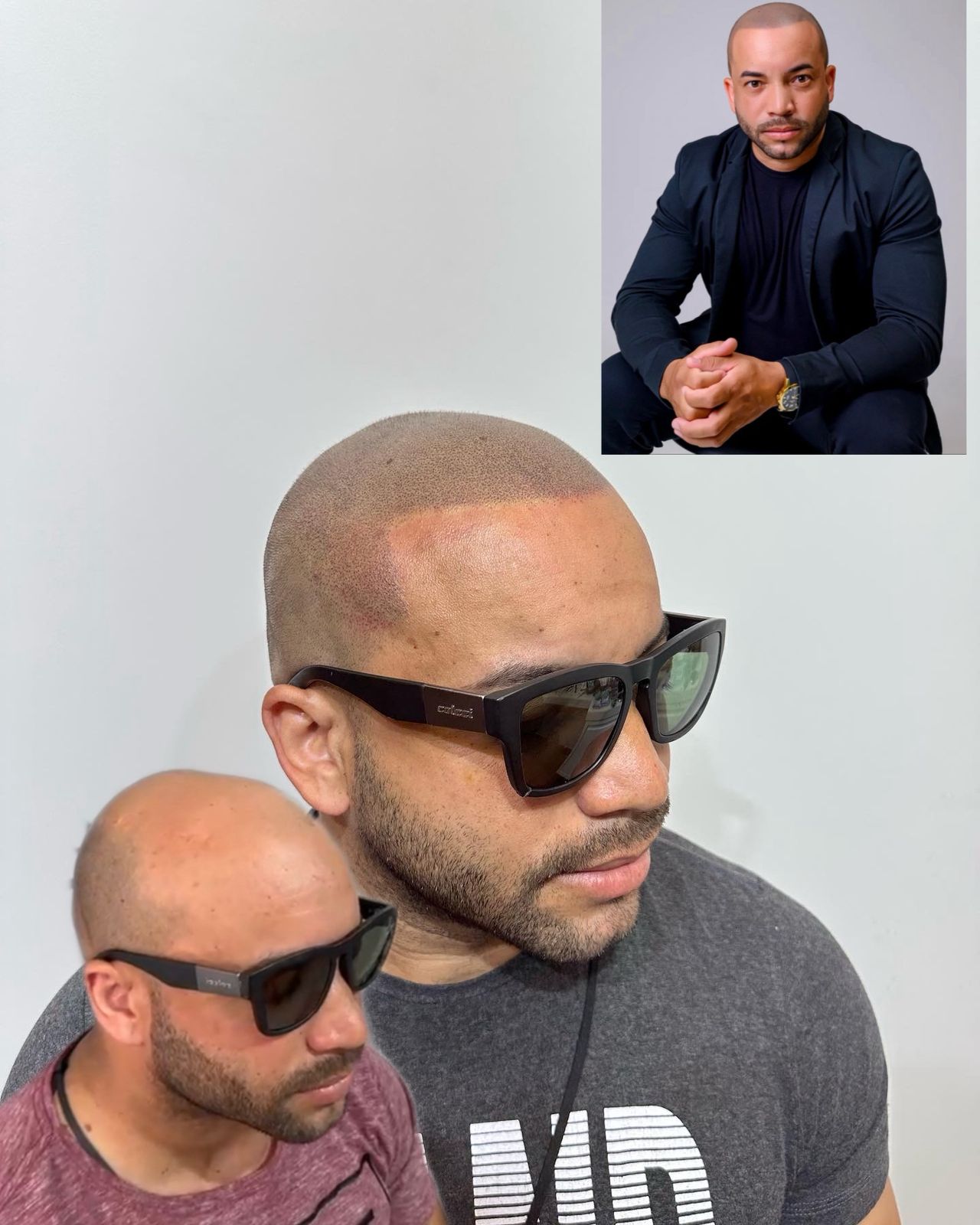 Johnnie Alves Capilar Facebook ad: Faça uma avaliação agora