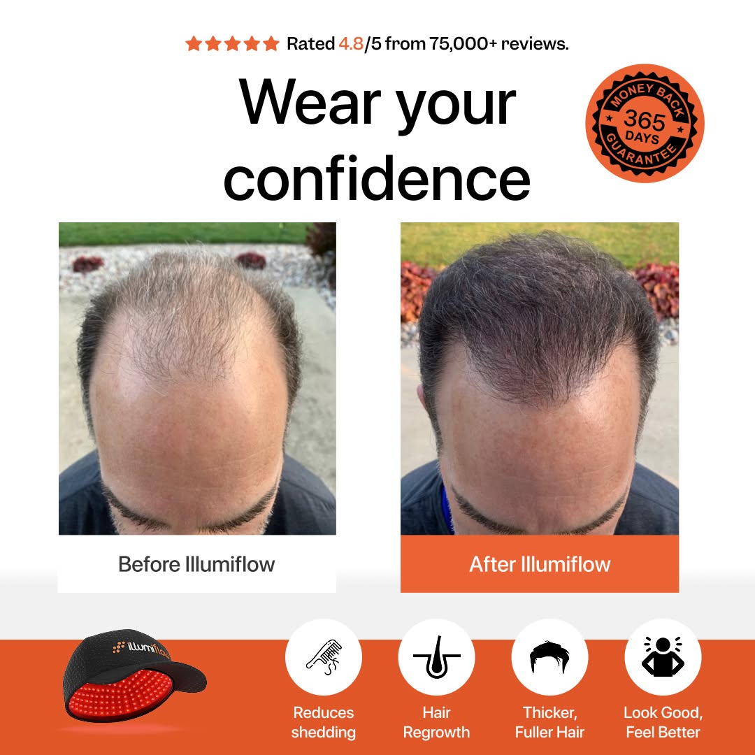IllumiFlow Facebook ad: FDA-Cleared Hair Loss Solution