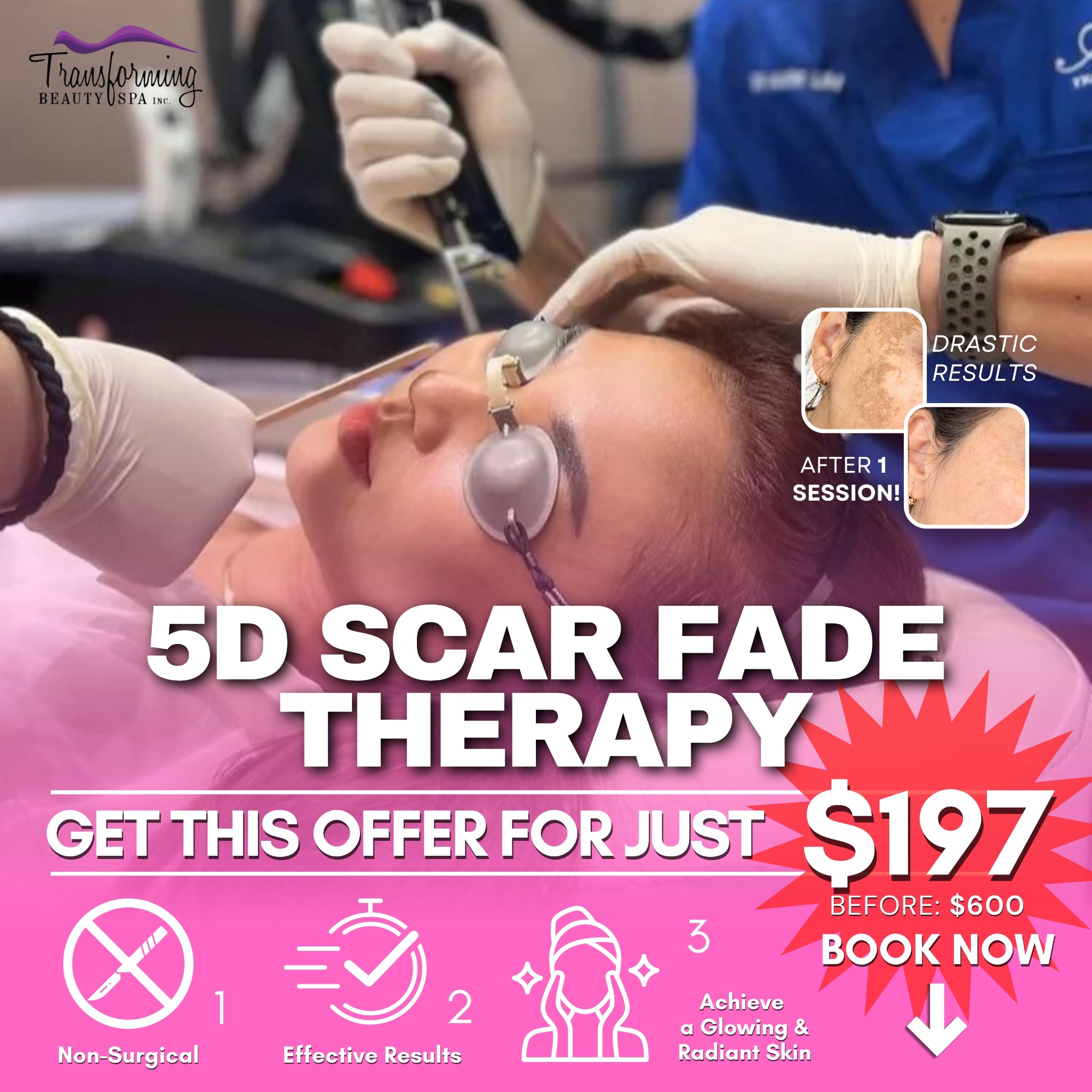 Transforming Beauty Facebook ad: 5D Scar Fade Therapy For $197 Only