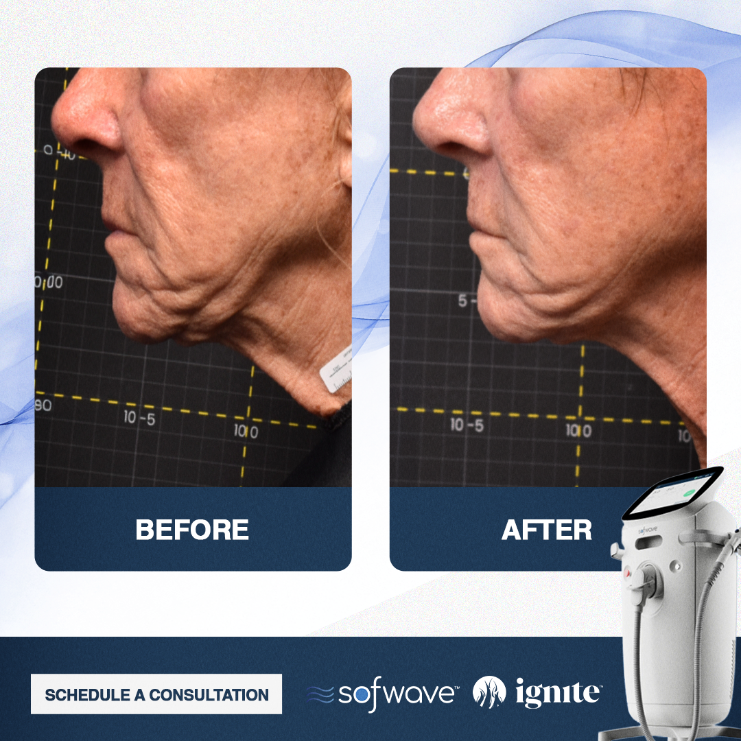 Ignite Orthopaedic & Wellness Clinic Facebook ad