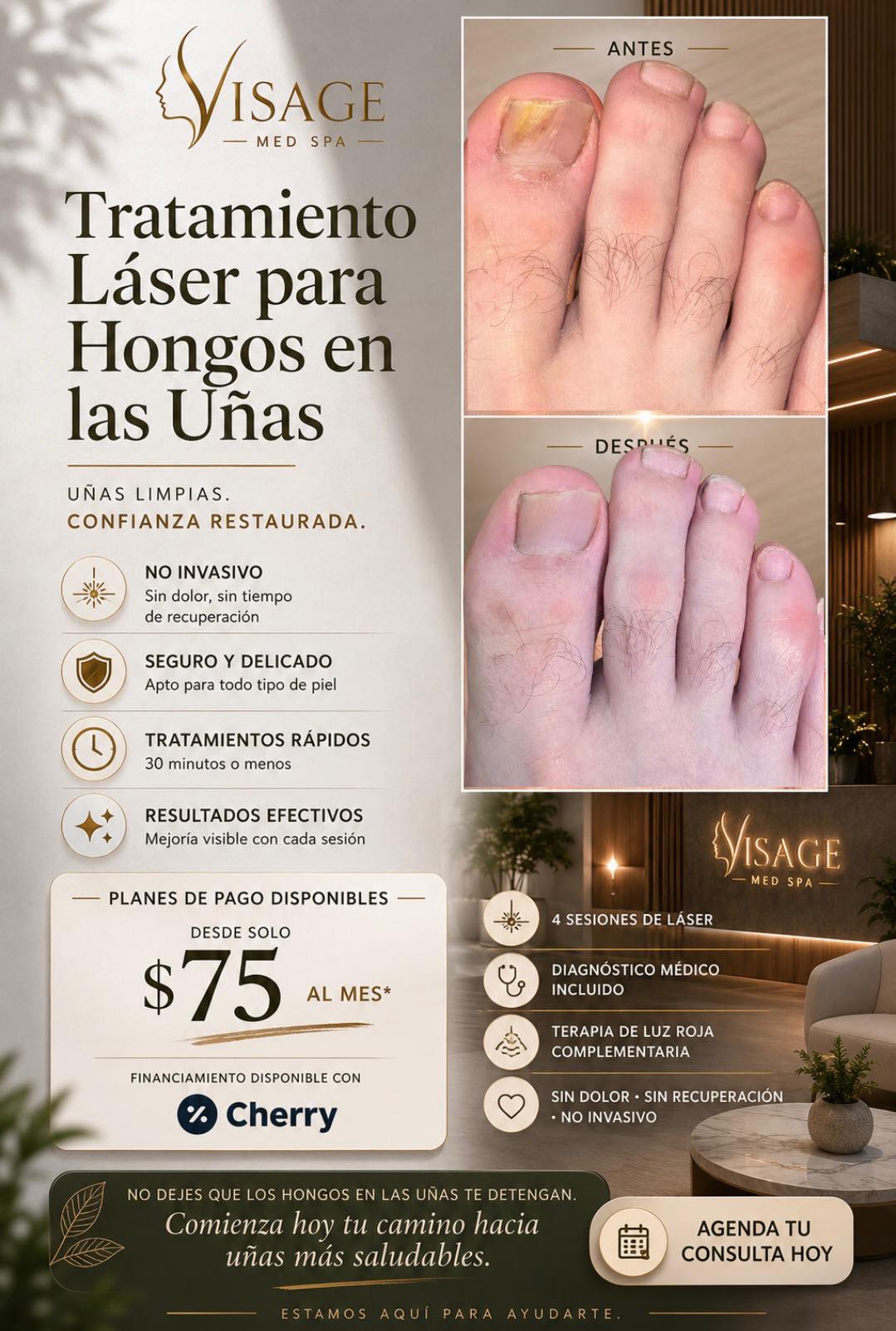Visage Medical, Spa & skin laser Facebook ad: ¿Uñas amarillas, gruesas o quebradizas?