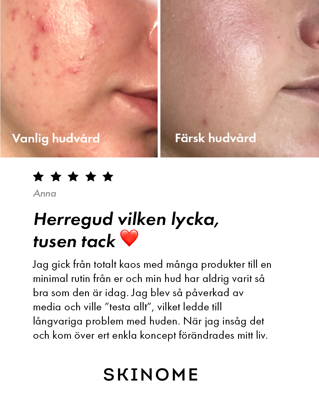 Skinome Facebook ad