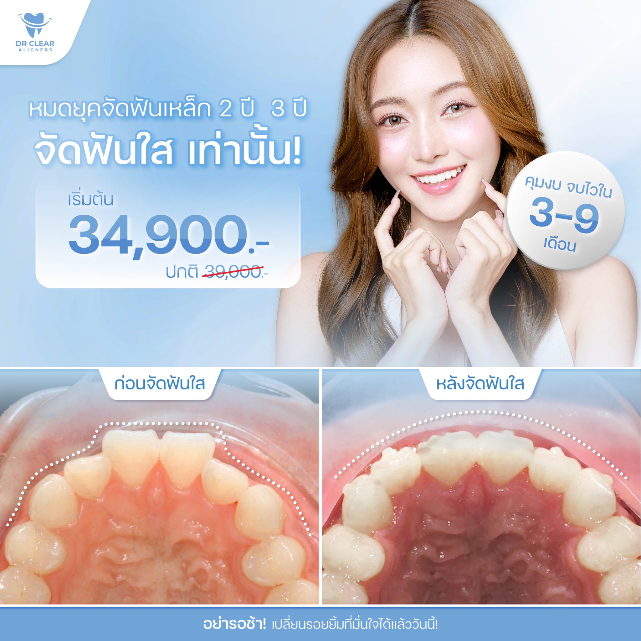 Dr Clear Aligners Thailand Facebook ad