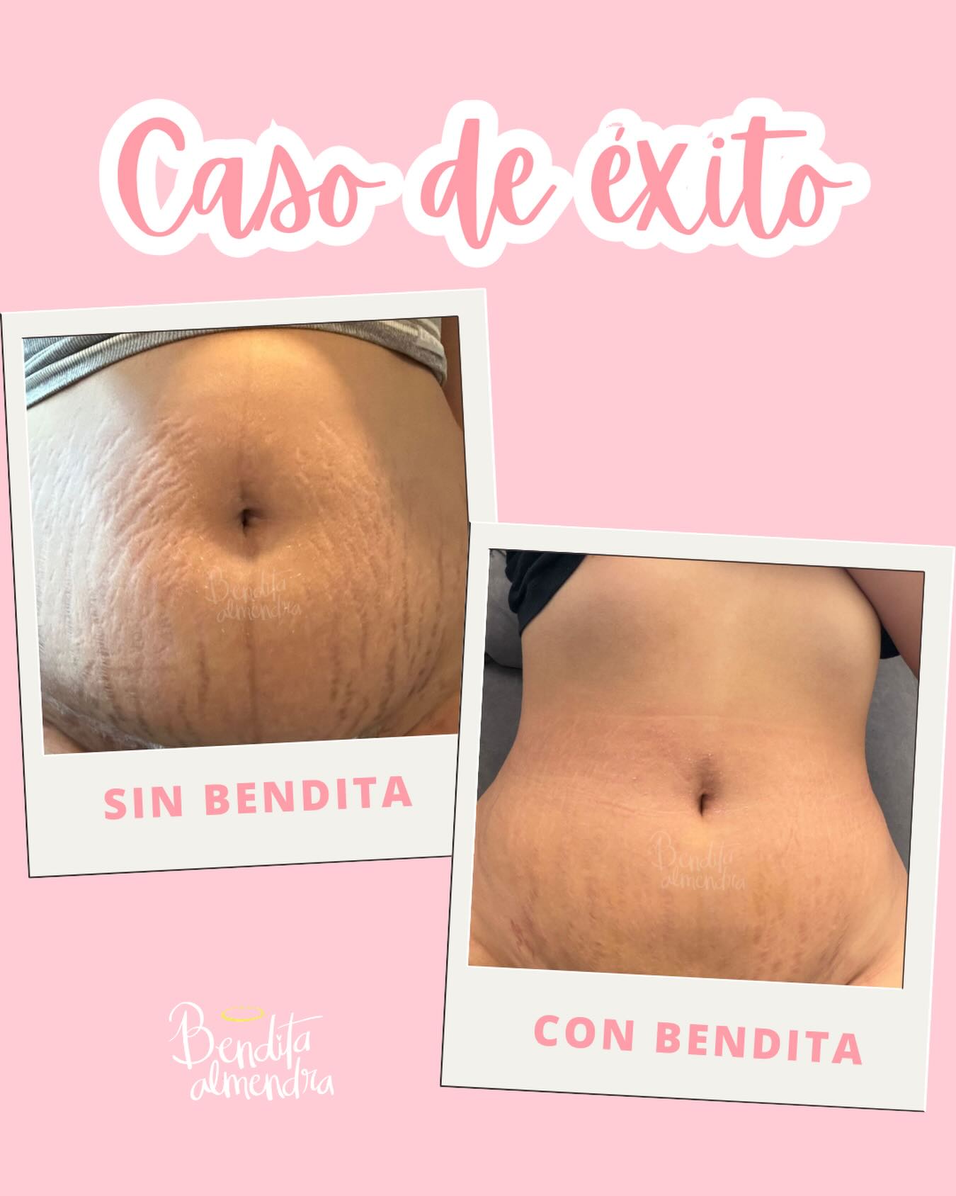 Bendita Almendra Facebook ad: Resultados que hablan por sí solos Menos apariencia…