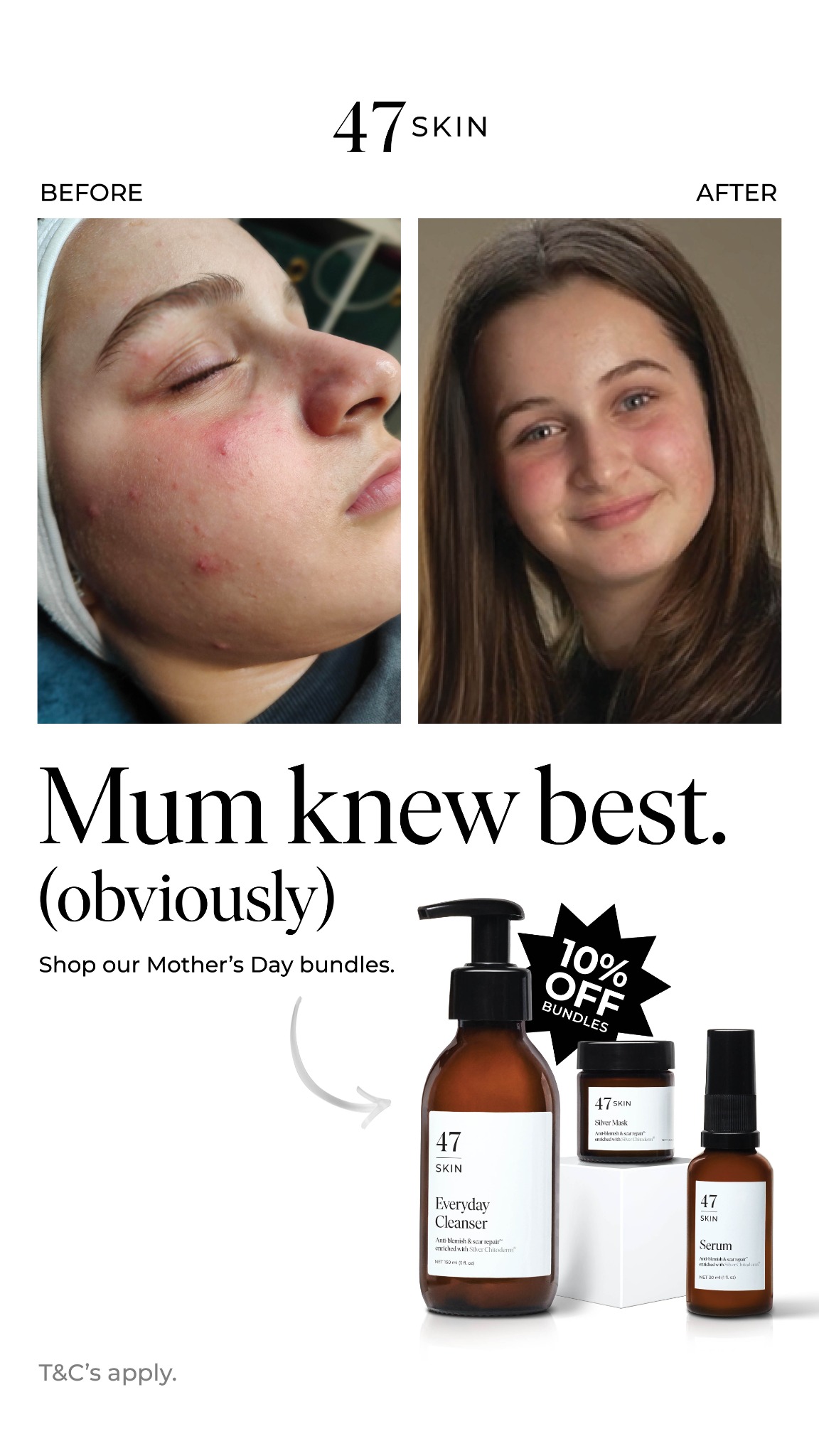 47Skin Facebook ad