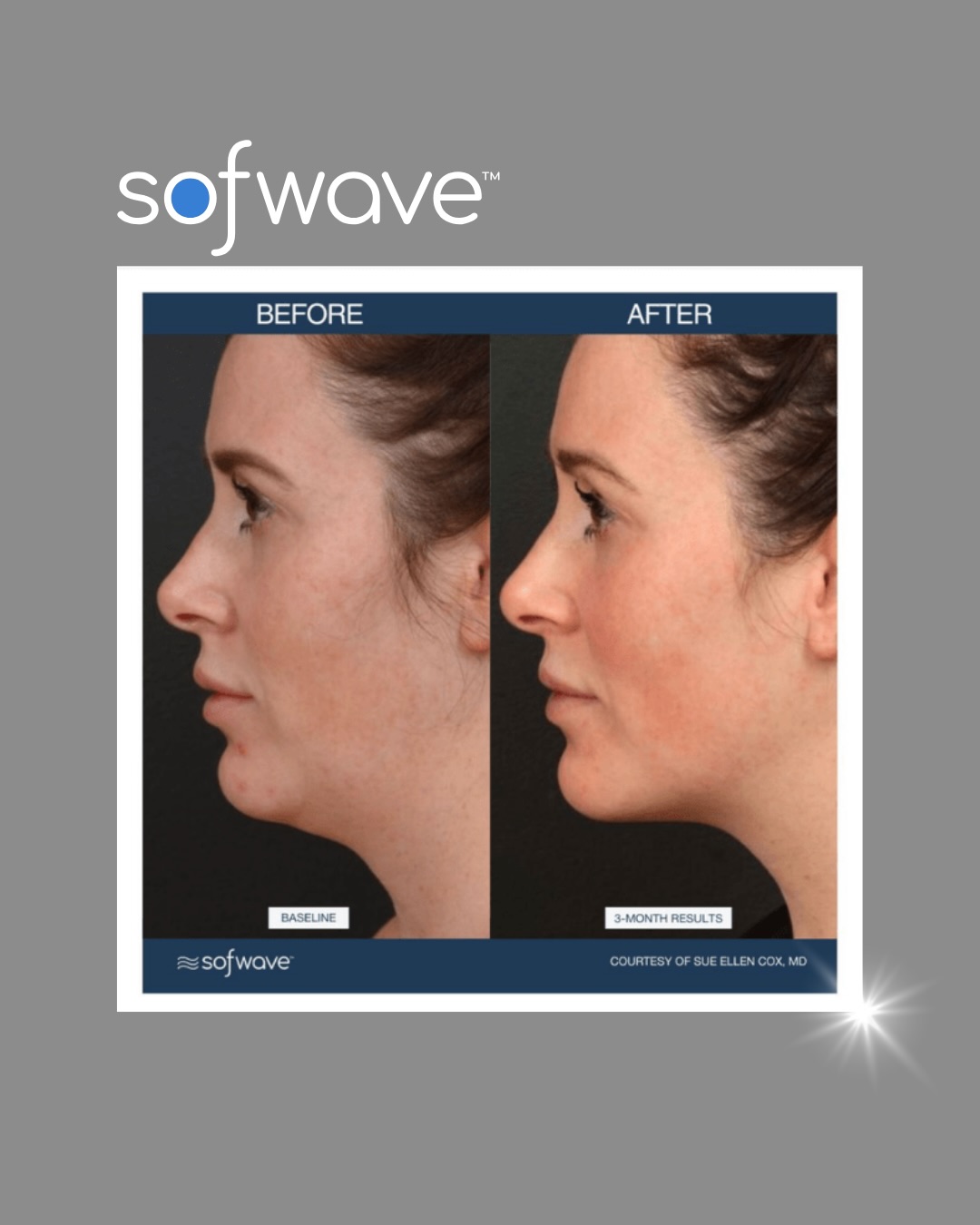 Empower MedSpa Facebook ad