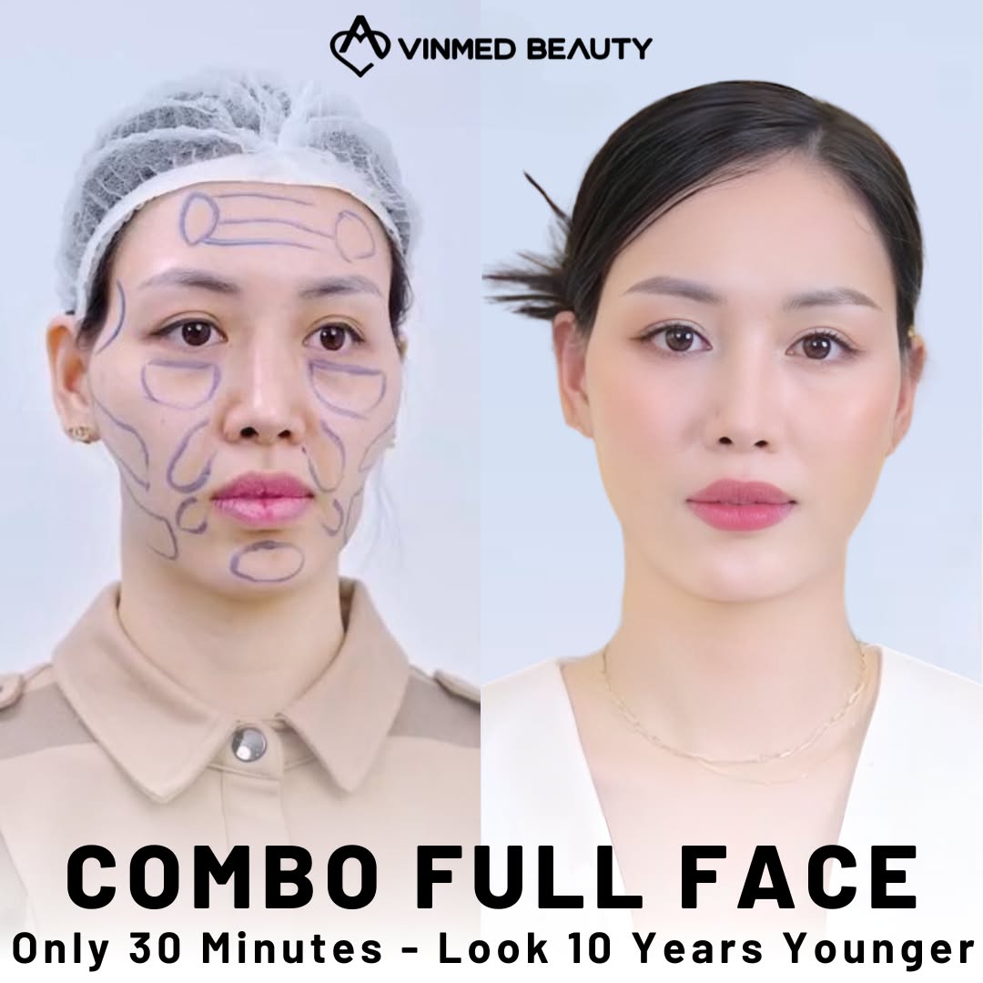 Vinmed Beauty - No. 1 Dermatology salon in Dubai Facebook ad