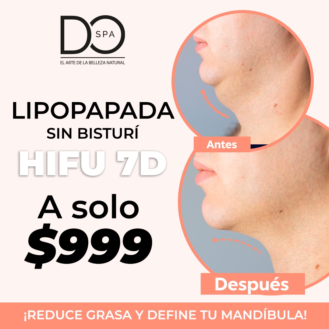 Do spa - La Estancia Facebook ad: Lipopapada Sin Cirugía! (HIFU)