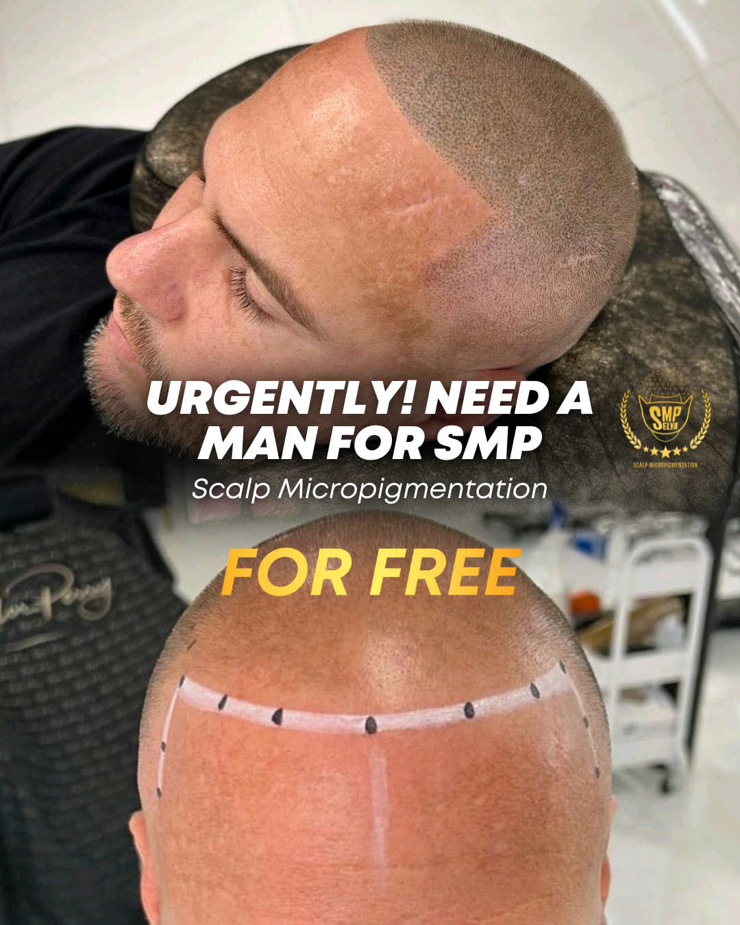 Сергей #Novoselya Facebook ad: MODEL NEEDED, FREE SCALP MICROPIGMENTATION