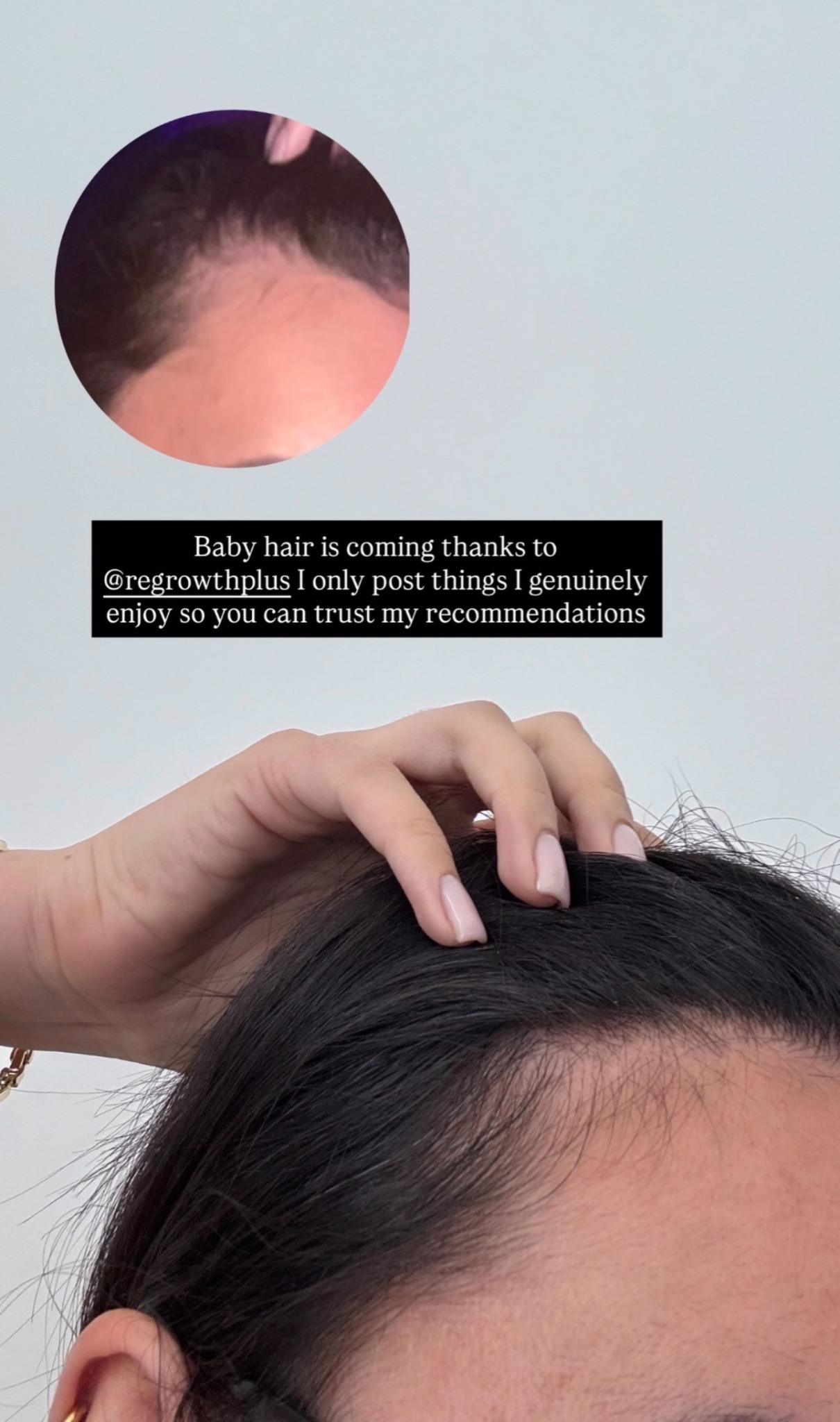 Regrowth+ Facebook ad
