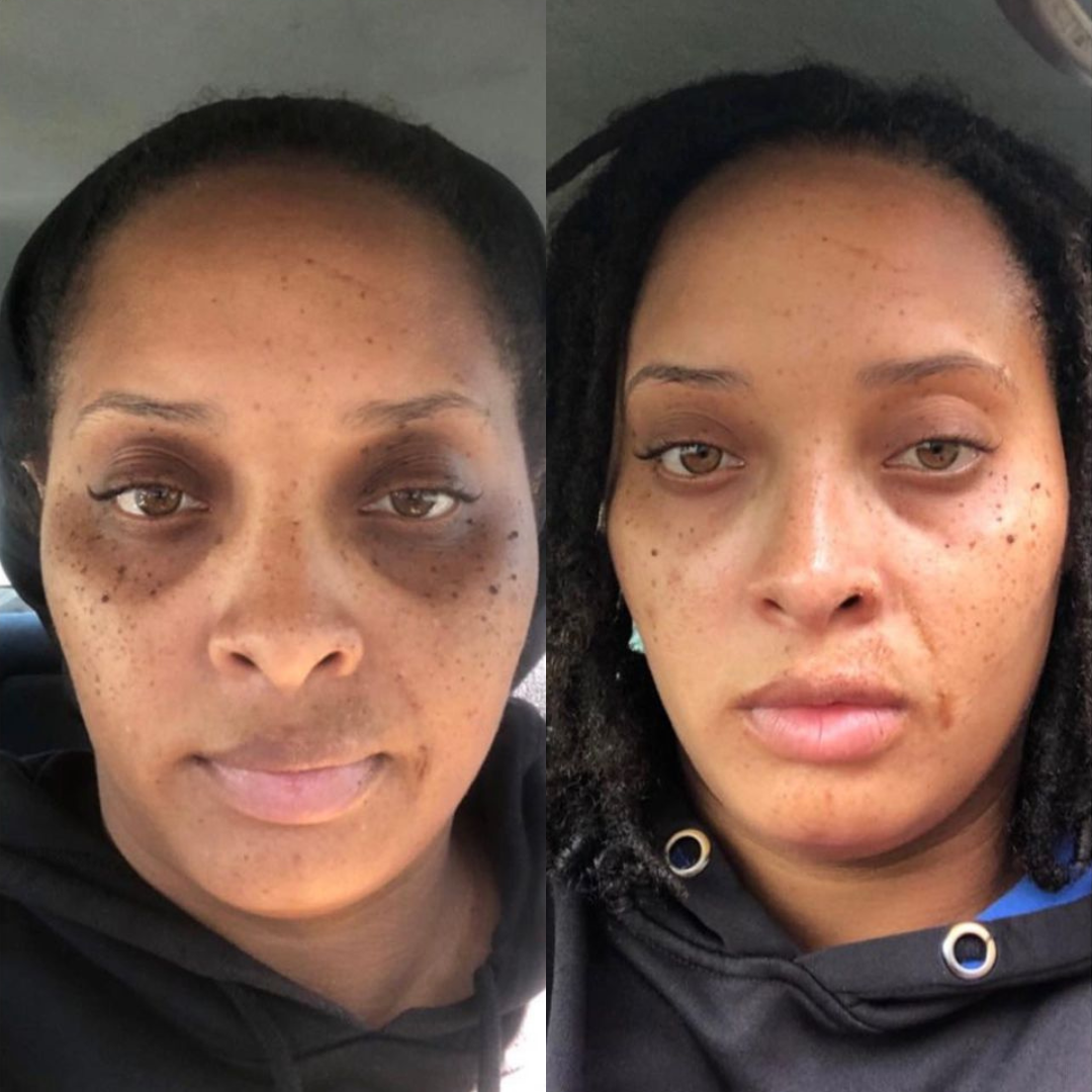 Tones By Cocoa Facebook ad: All-natural skincare backed by results Get 20% off…