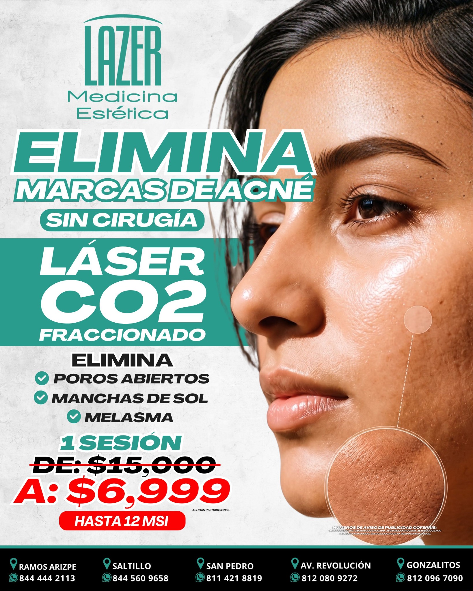 Lazer Medicina Estética MX Facebook ad