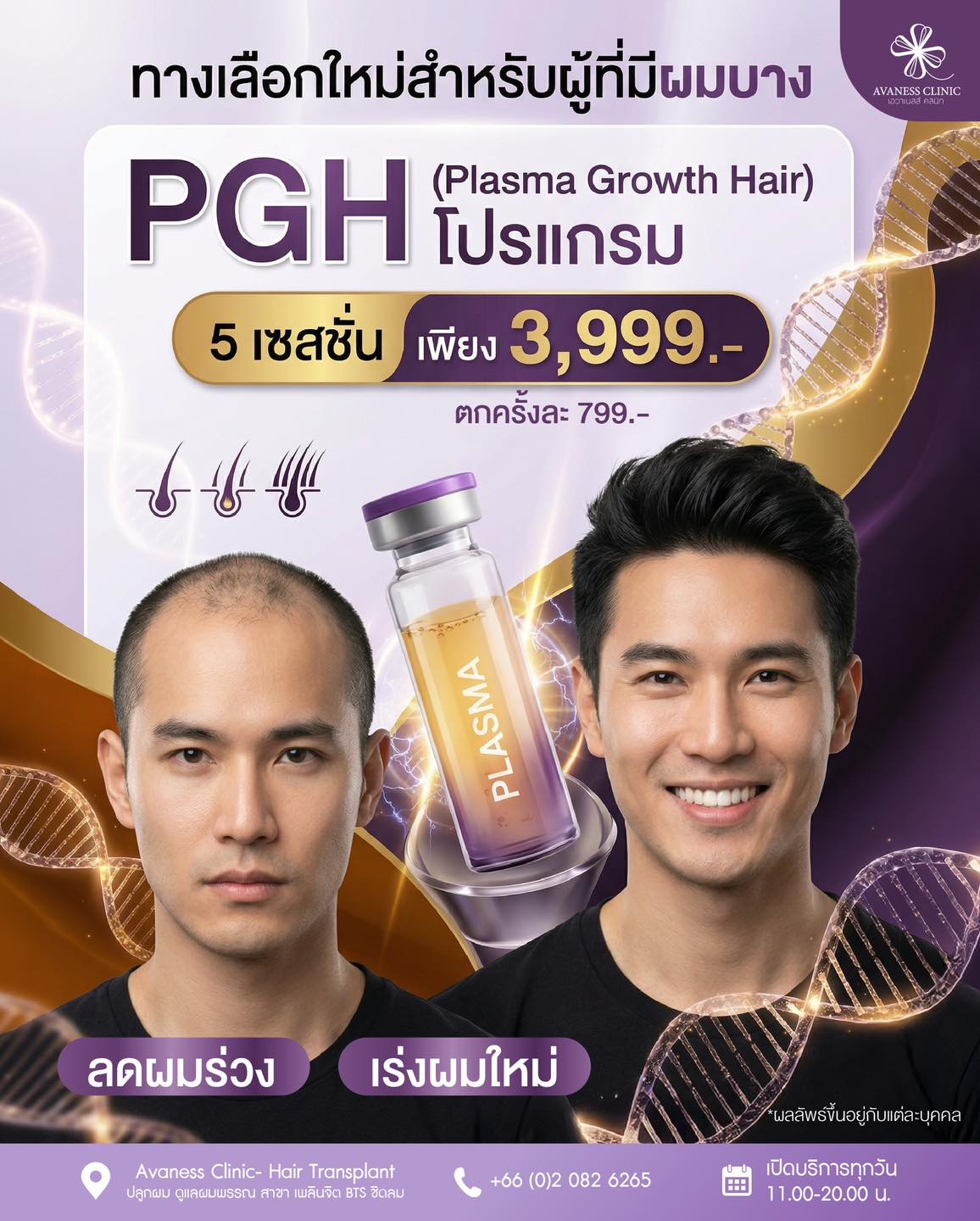 Avaness Clinic- Hair Transplant ปลูกผม ดูแลผิวพรรณ สาขา เพลินจิต BTS ชิดลม Facebook ad: ทางเลือกใหม่ของคนผมบาง