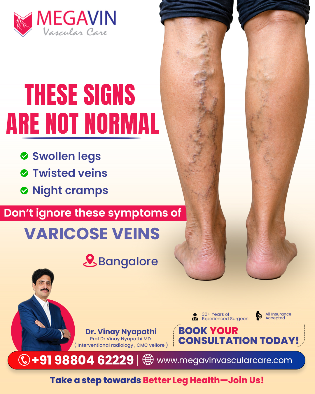 Megavin Vascular Care - Bangalore Facebook ad: Varicose Veins Treatment in Jayanagar