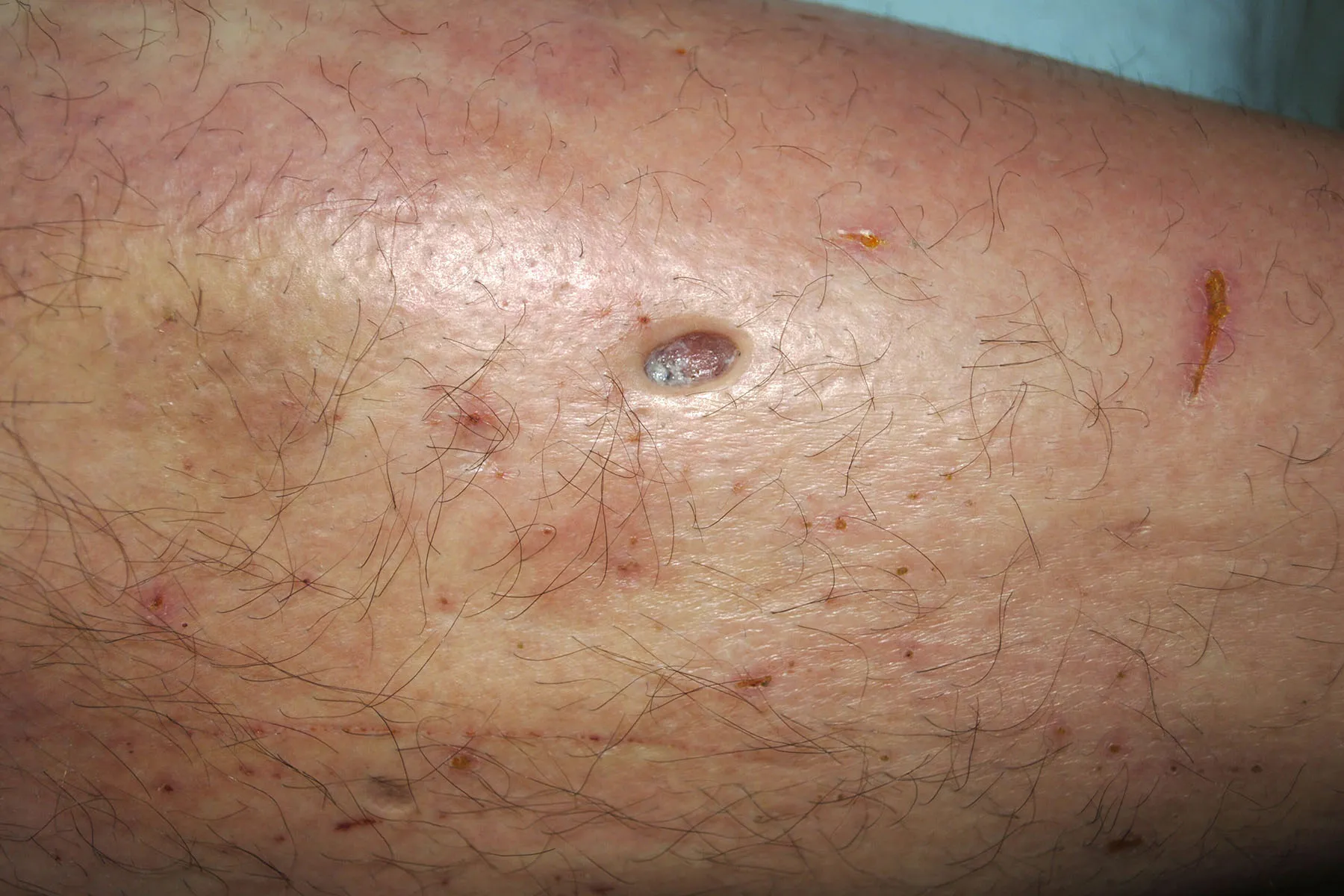 Dr. Ian Thomas Facebook ad