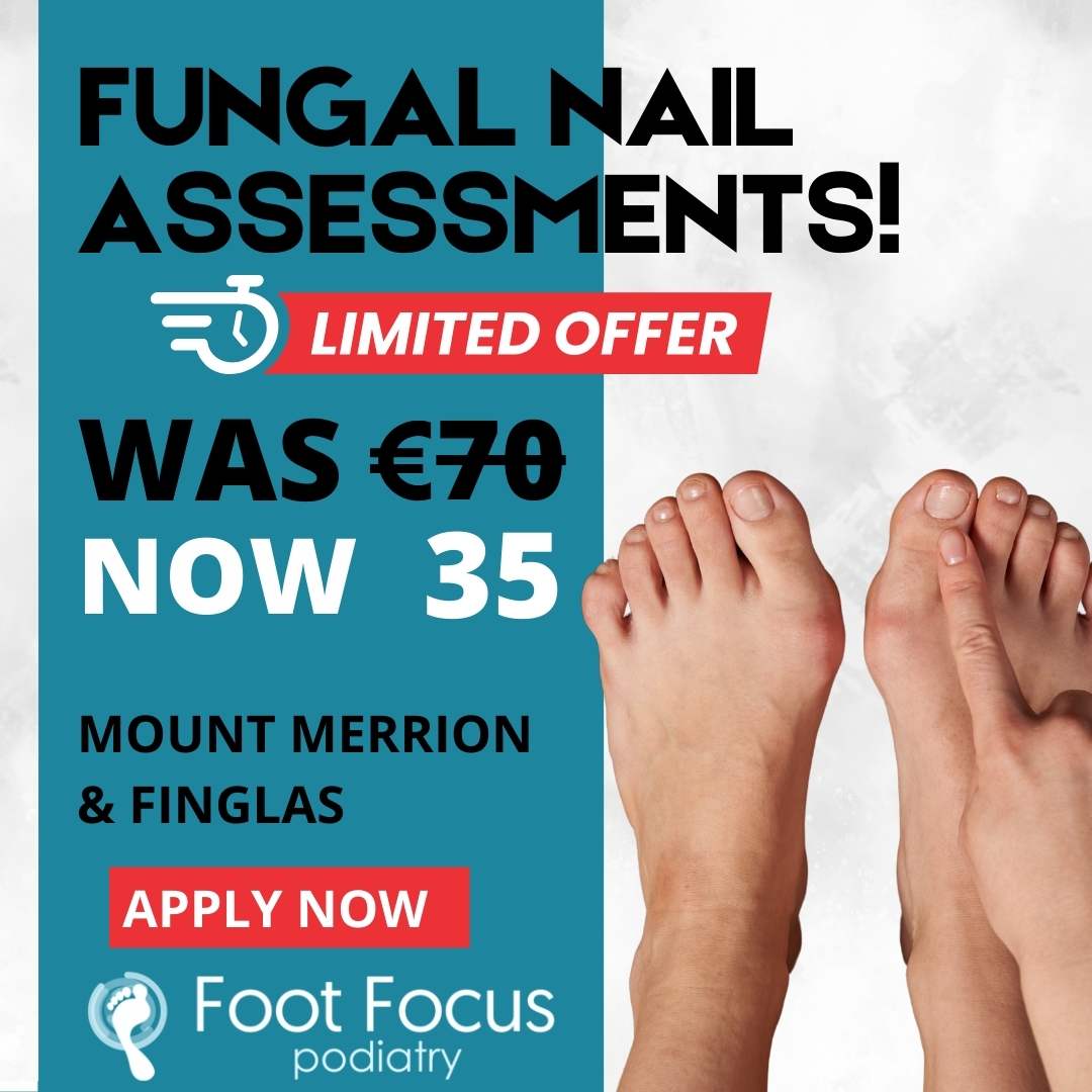Foot Focus Facebook ad: Book Your Discounted Appointment Now