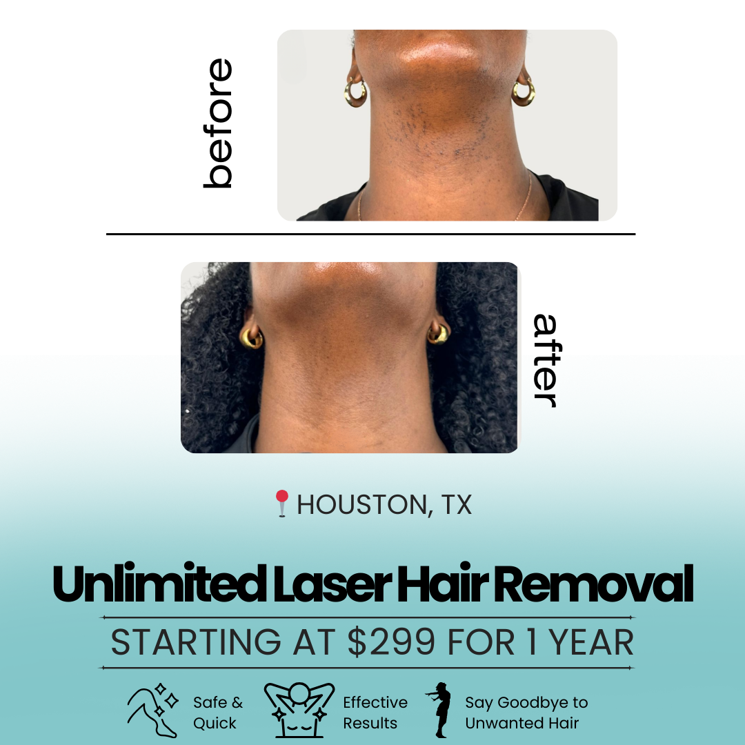 Camellia Alise Facebook ad: Unlimited Laser Hair Removal for 1 Area for 1 Full Year…