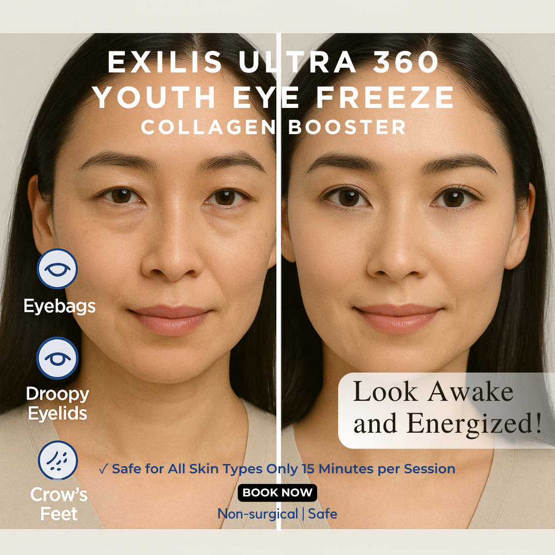 Bellezza Aesthetics Facebook ad