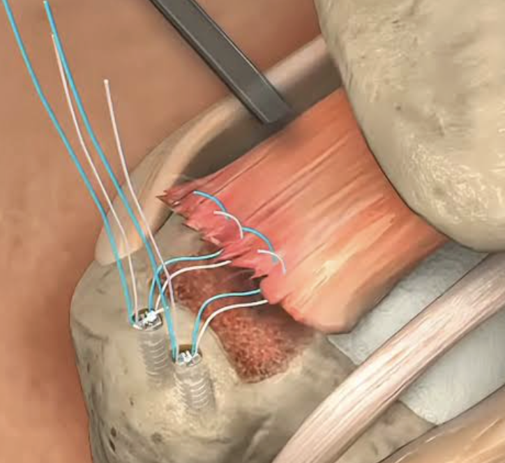 Dr. Elizabeth Monroe, MD Facebook ad: End That Chronic Pain in 3 Weeks