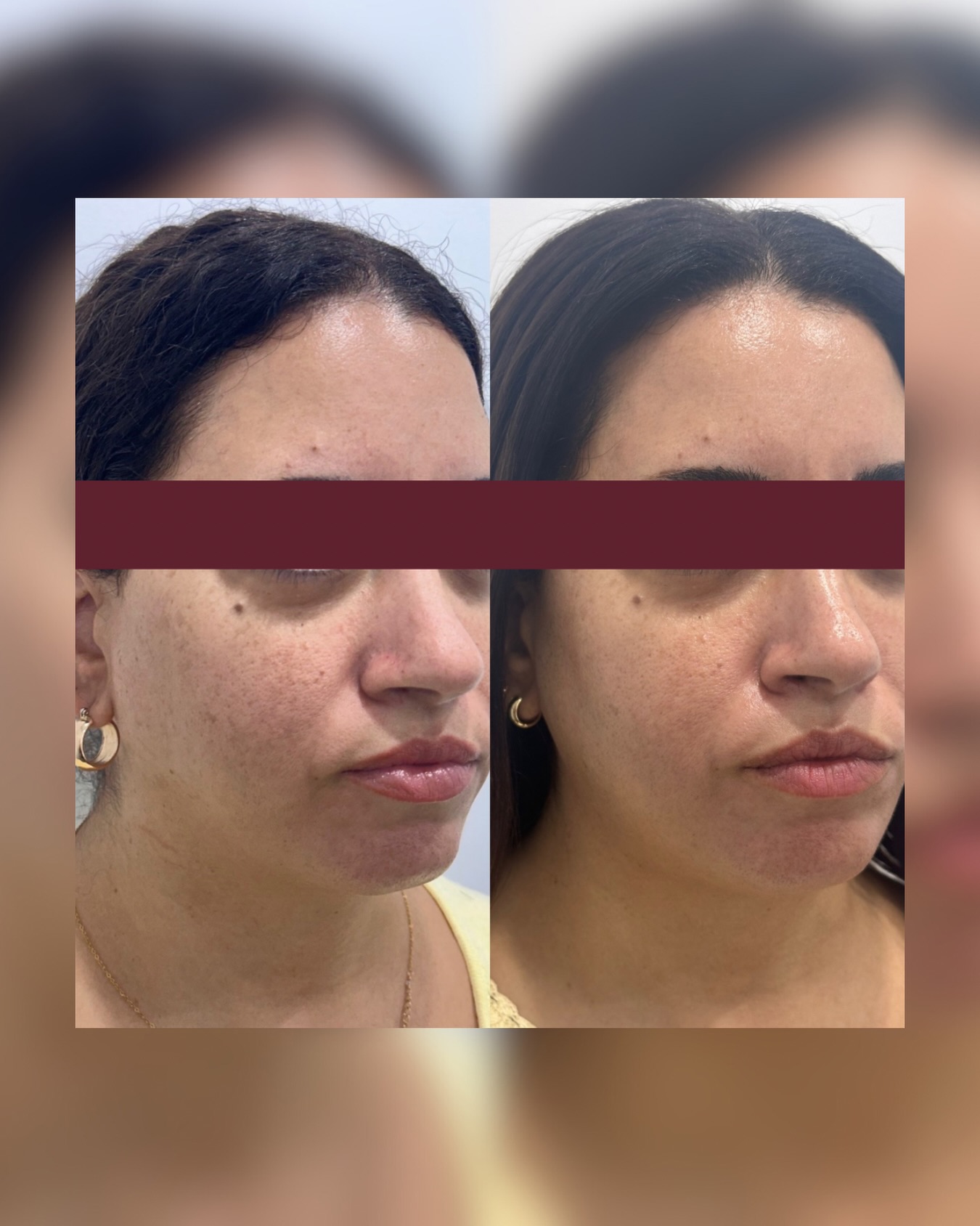 Skin Studio By Laura Facebook ad: Chat with us
