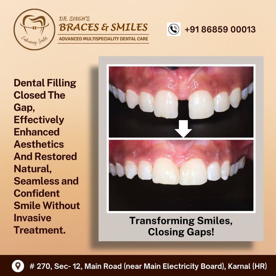 Dr. Singh's - Braces & Smiles Facebook ad: Let's transform your smile by closing the gaps…