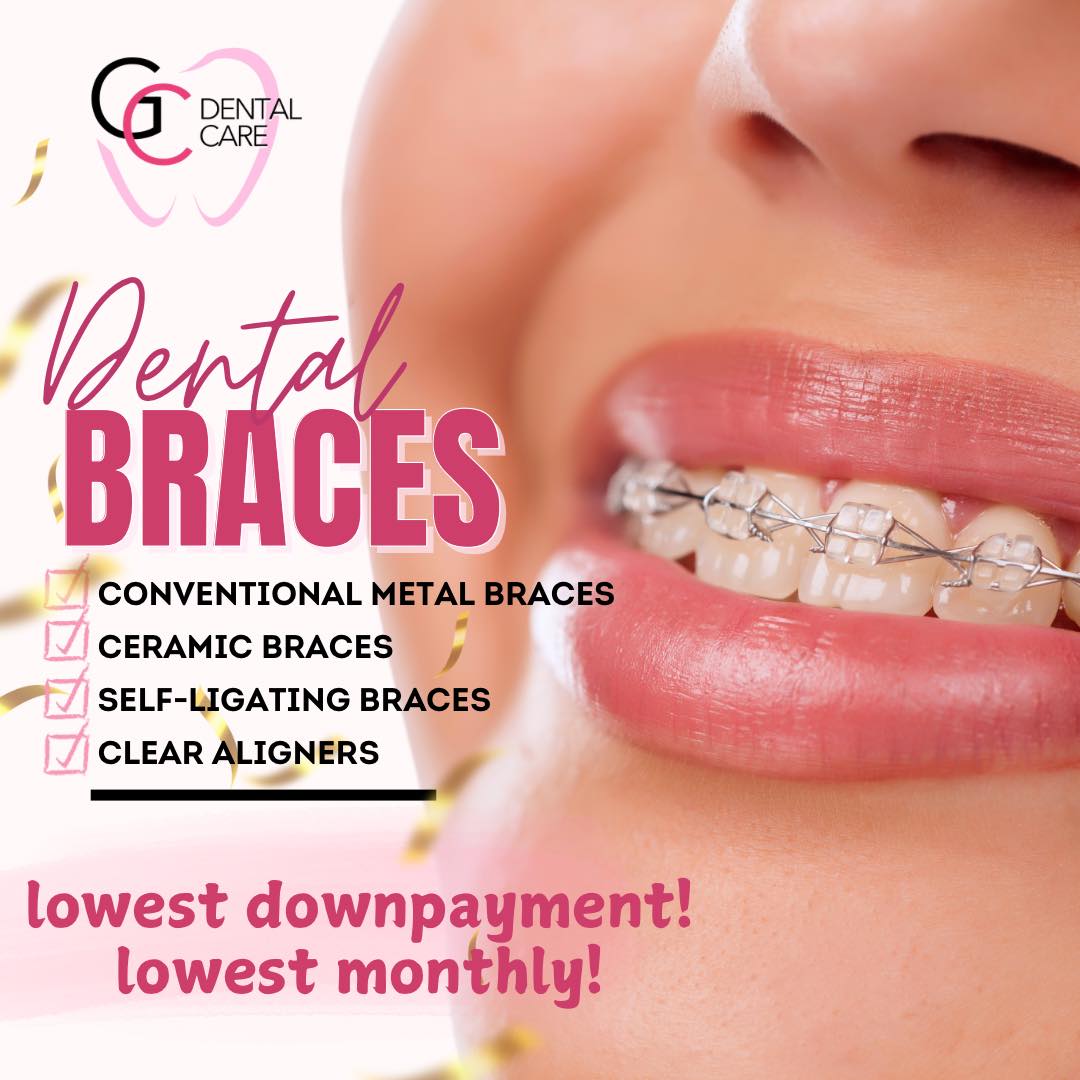 GC Dental Care Facebook ad