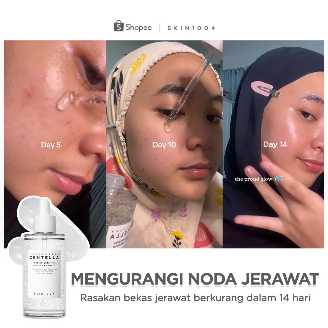 SKIN1004_Indonesia Facebook ad