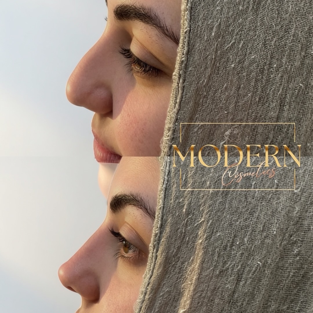 Modern Cosmetics Facebook ad: At Modern Cosmetics, we offer personalised consultations…