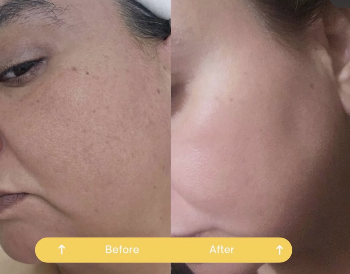 Msskin Facebook ad: Australia's First Turmeric Mask