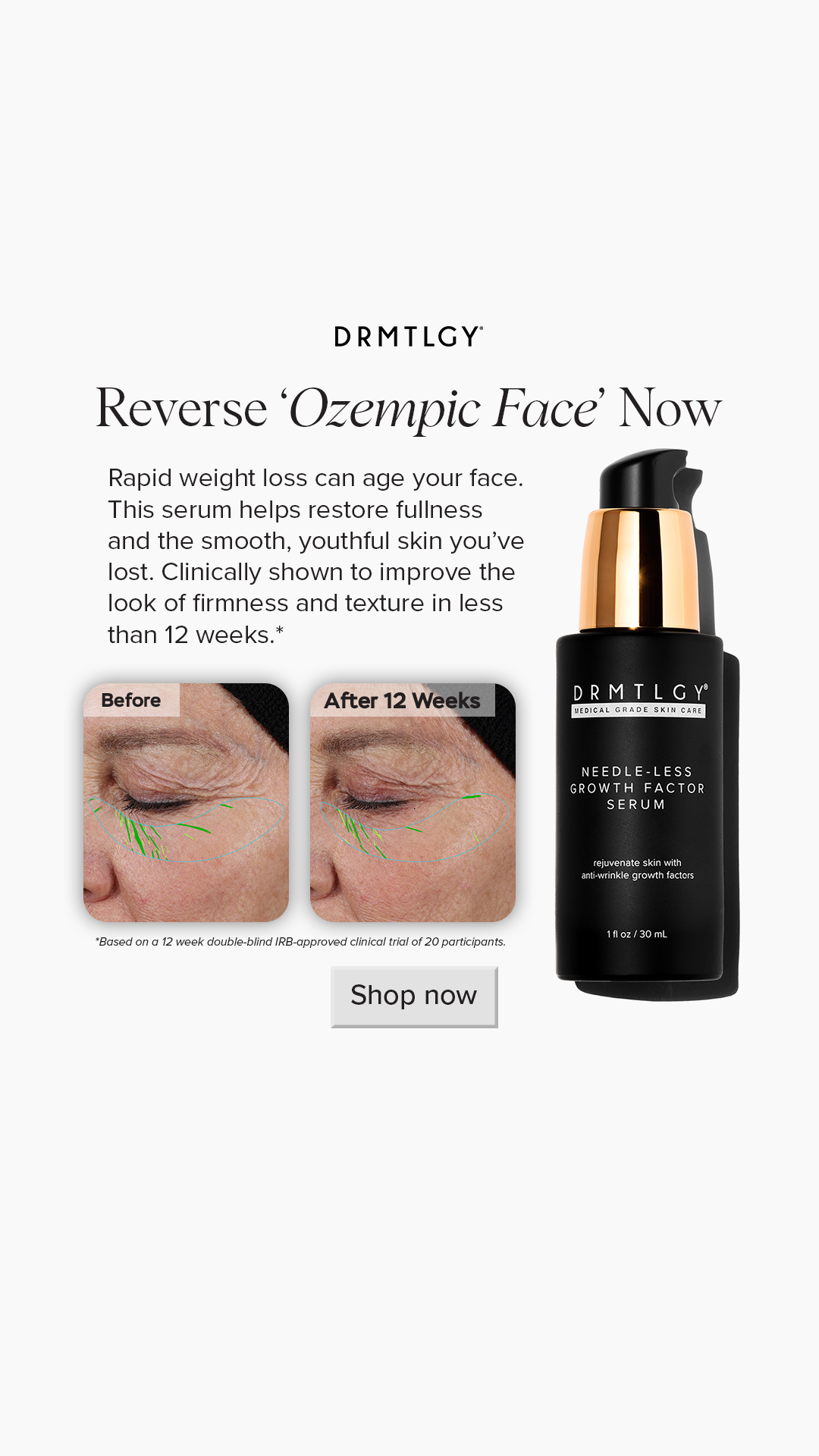 DRMTLGY Facebook ad