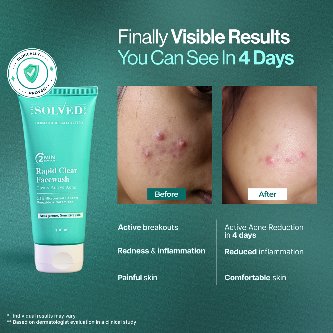 The Solved Skin Facebook ad: This isn't your average wash.