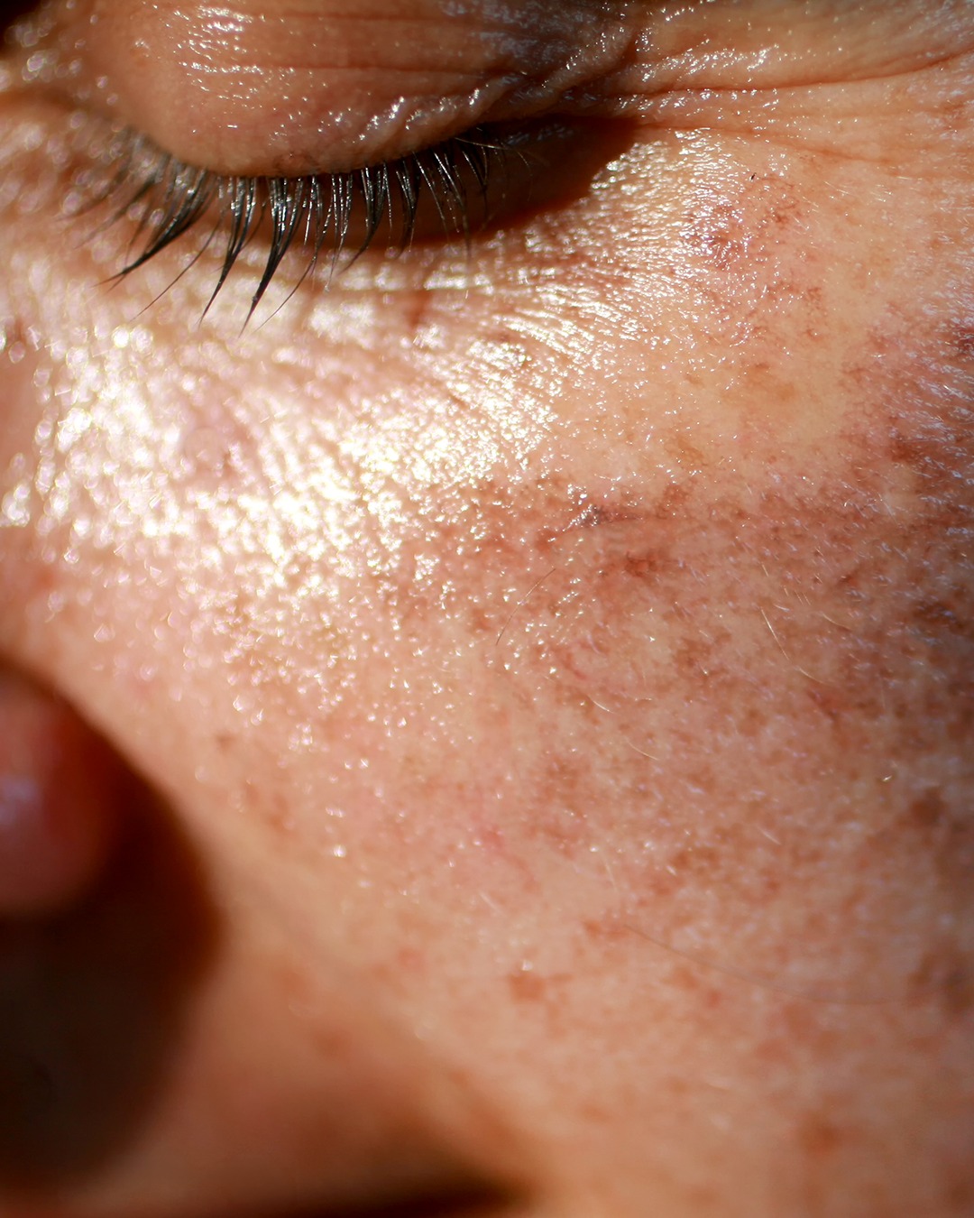 Skinmed AG Facebook ad: Skinmed | Klinik für Dermatologie & plastische Chirurgie