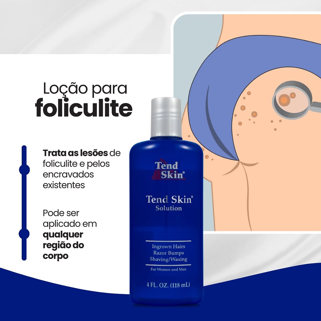 Tend Skin Brasil Facebook ad