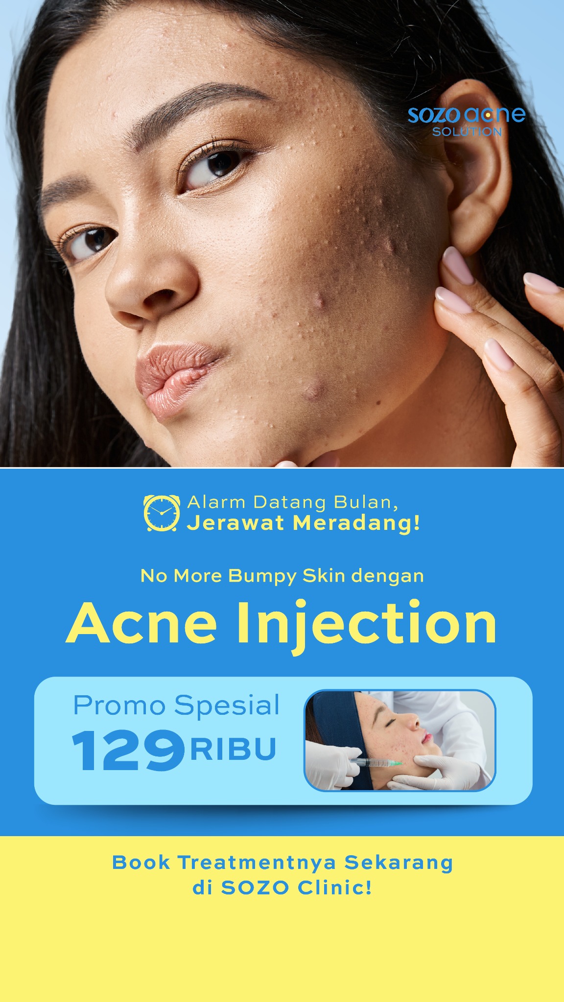 Sozo Skin Clinic Facebook ad