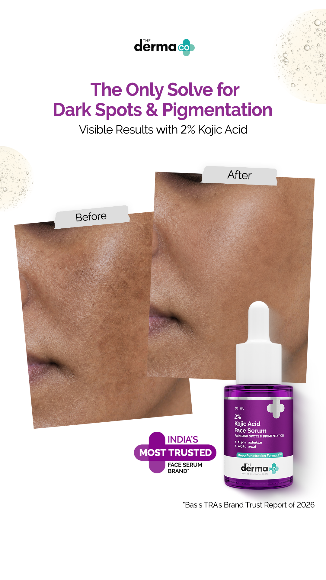 The Derma Co. Facebook ad