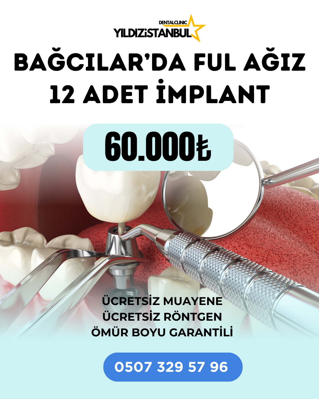 Yıldızdentalistanbul Facebook ad: Ücretsiz Muayene Ol