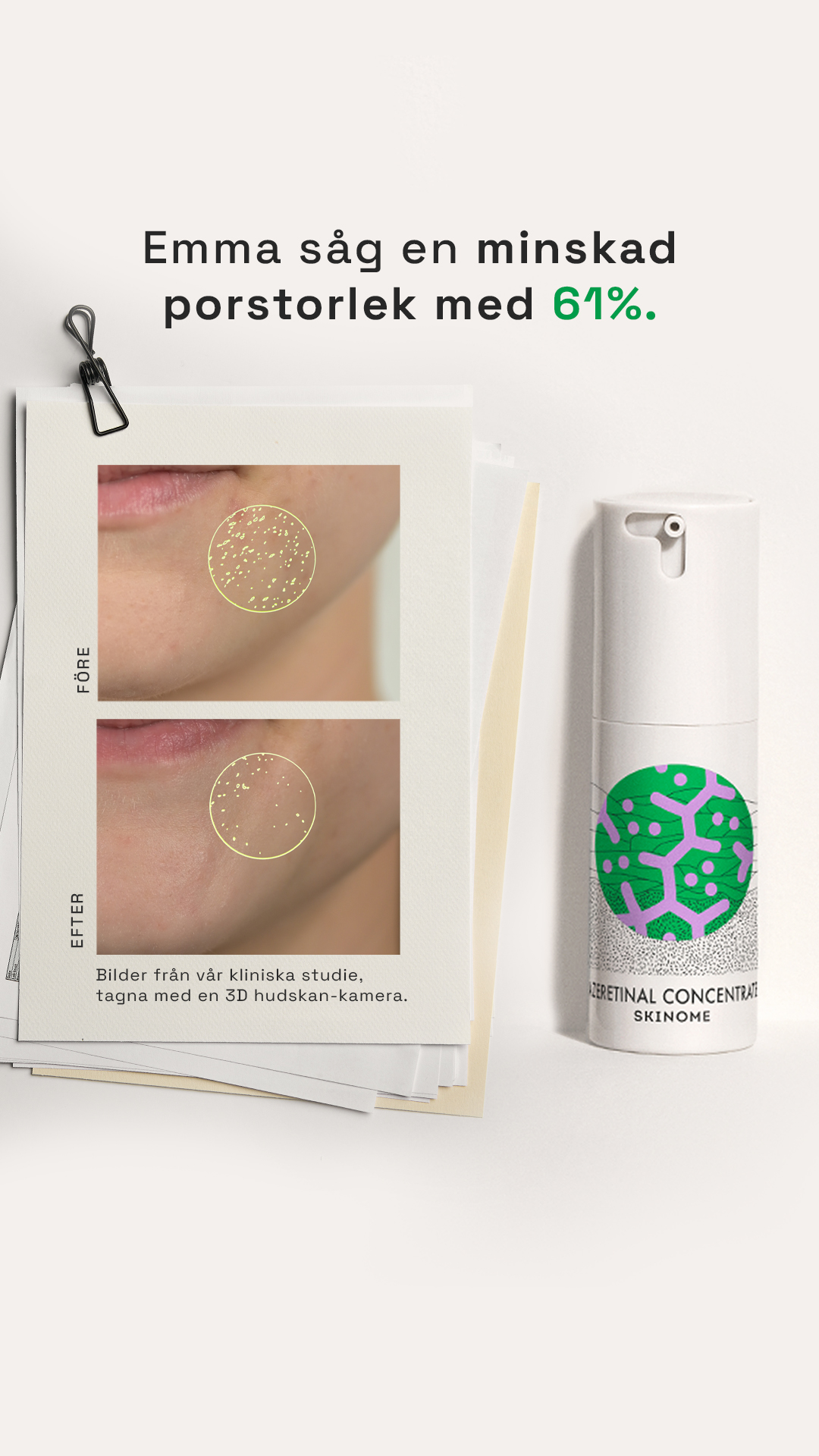 Skinome Facebook ad