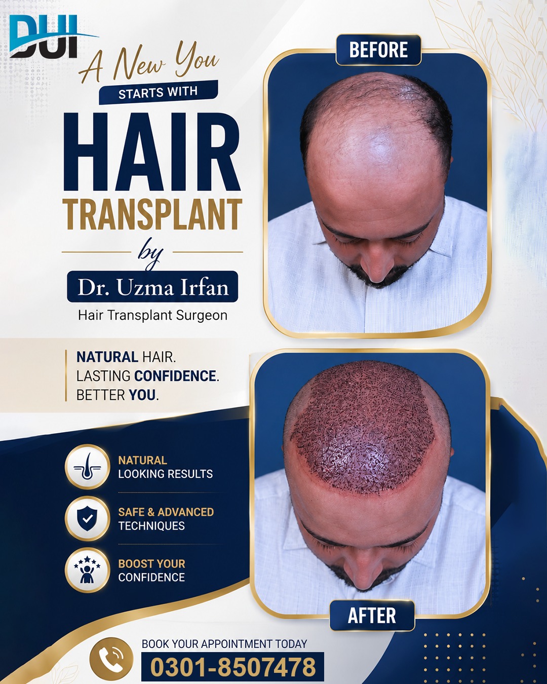 Dr Uzma Irfan Facebook ad: Your Hair, Our Expertise, A New You!